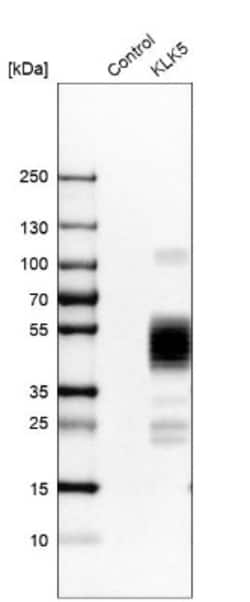 Kallikrein 5 Antibody, Novus Biologicals 25 &mu;L | Buy Online | Novus Biologicals | Fisher Scientific